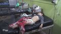 More than 100 killed in Assad sarin attack on Idlib's Khan Sheikhoun - 1m12s.jpg