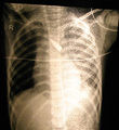 X-ray kid.jpg