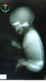 Fetus with Misrata magic bullet - full.png