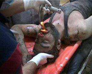 August 2 Aleppo chlorine victim.jpg