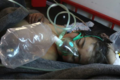 Idlib gas dead 7.png