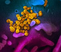 Taudin aiheuttavia viruksia (keltaiset) niiden purkautuessa ulos solusta. Väritetty pyyhkäisyelektronimikroskooppikuva.
