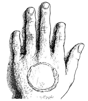 Araka-Kalai – Hand tattoo and severed fingers of the Dark Order.
