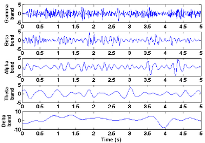 EEG Frequqencies