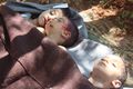 Khan Shaikhoun - boys with head wounds - ANA Press.jpg